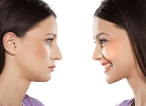 The Benefits of Choosing Ultrasonic Rhinoplasty for Nose Surgery in Dubai