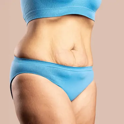 How to Find the Best Tummy Tuck Surgeon in Dubai: A Complete Guide