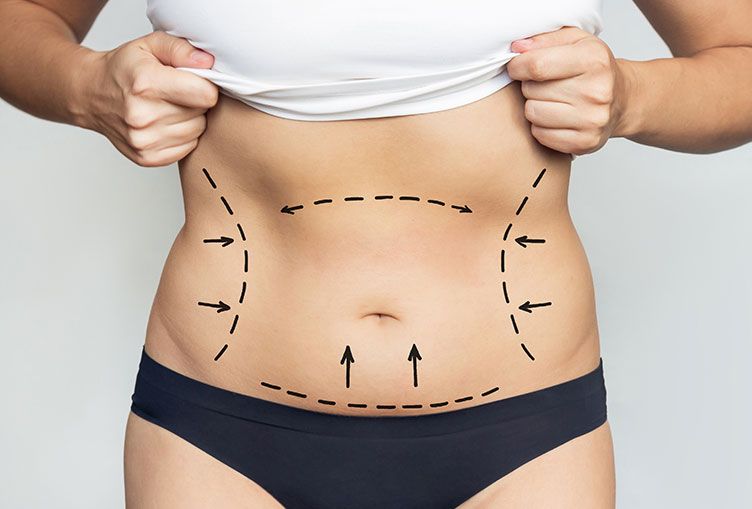 How the Best Tummy Tuck Surgeon in Dubai Ensures Patient Safety and Satisfaction