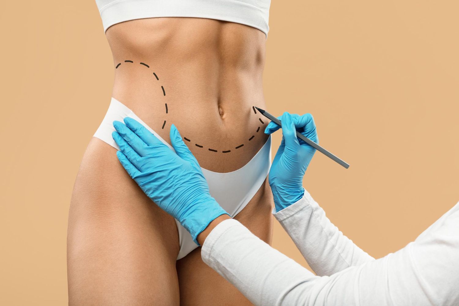 Who Is a Good Candidate for a Mini Tummy Tuck?