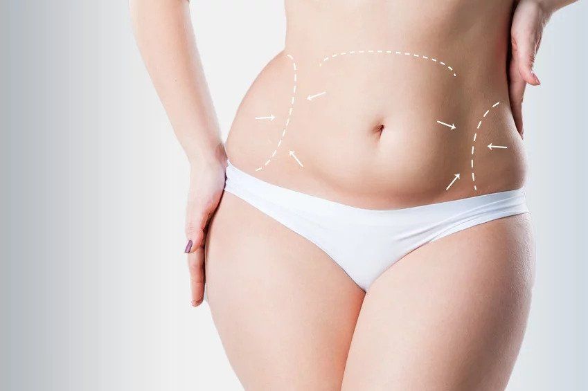 Tummy Tuck Dubai vs Non-Surgical Body Contouring Treatments